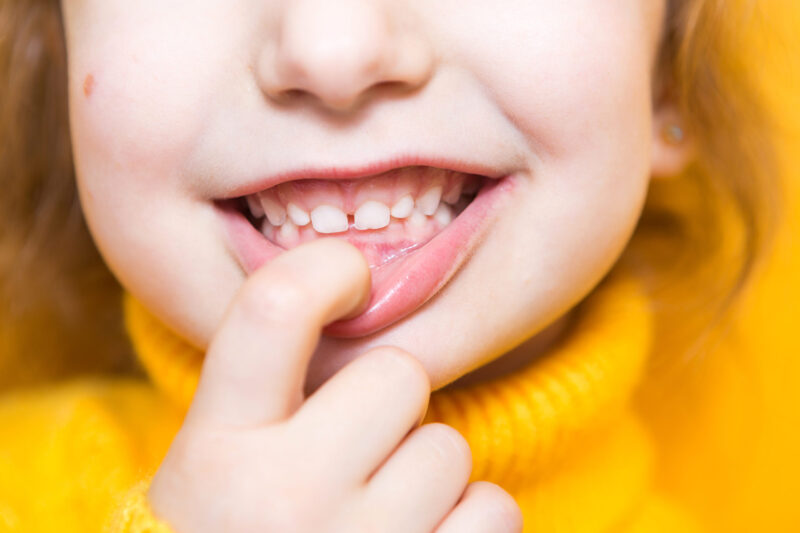 Pediatric Dentistry Near Me Pediatric Dentistry in Denton